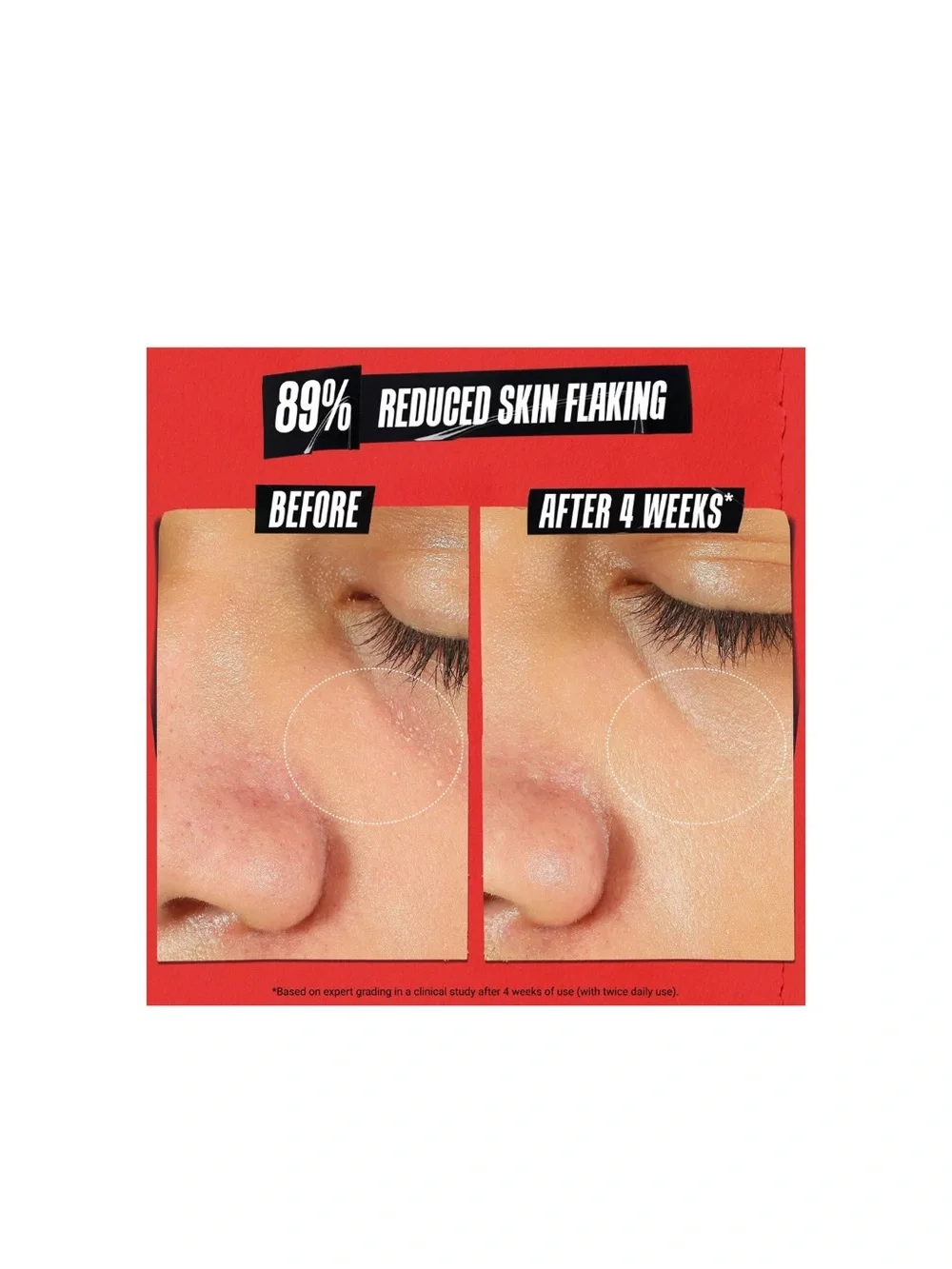 Kiehl's Ultra Facial Meltdown Recovery Cream Medicated NWT 1.6oz
